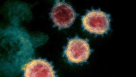 Eine Aufnahme des Corona-Virus im Elektronenmikroskop